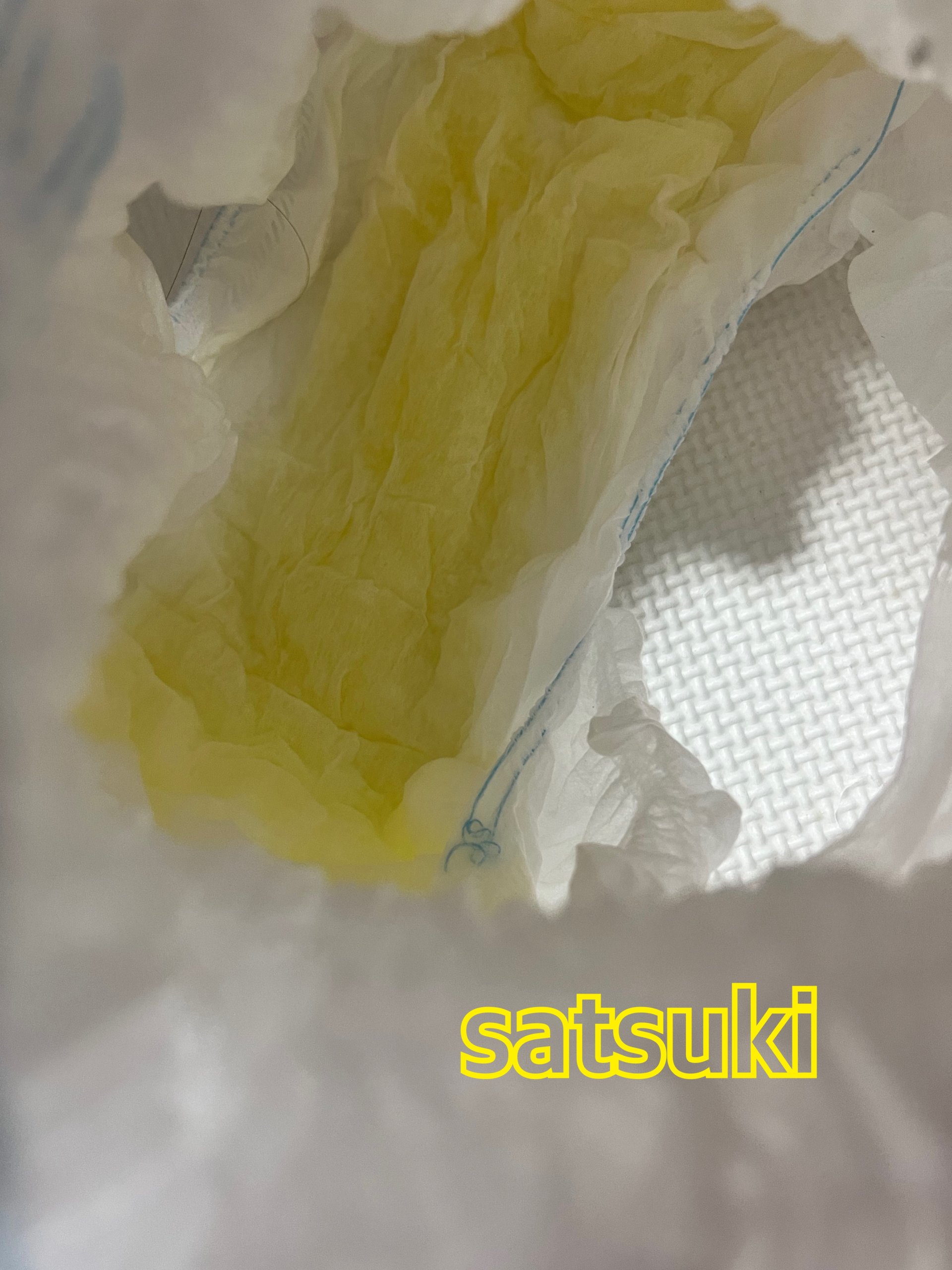 Massive…. Fest 💛✨‼️