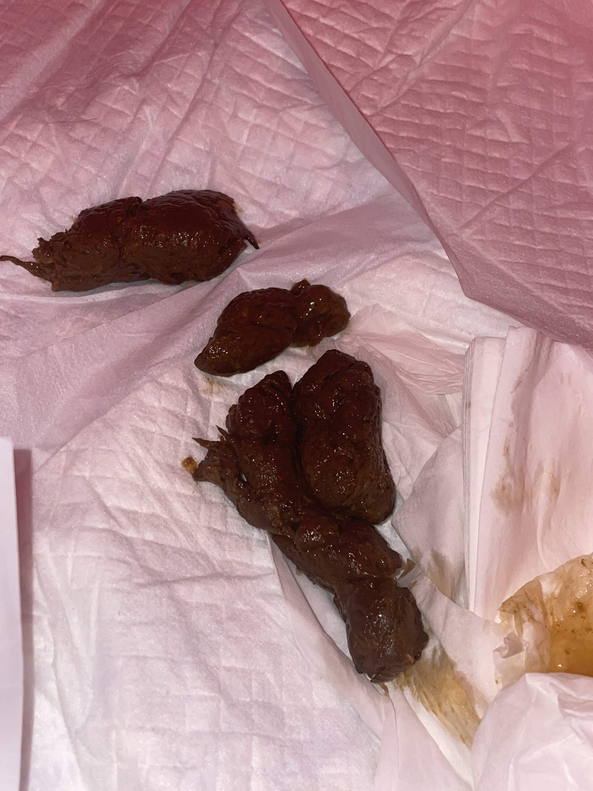 On the body…♡♡