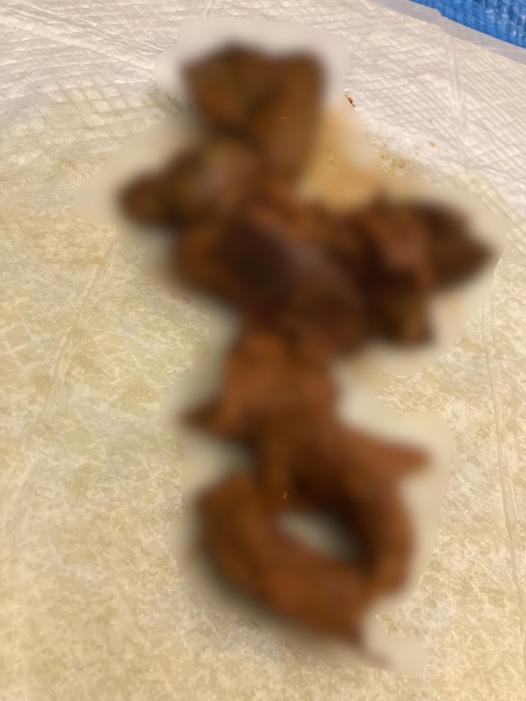 Lots of poop in front of Big Brother 💩