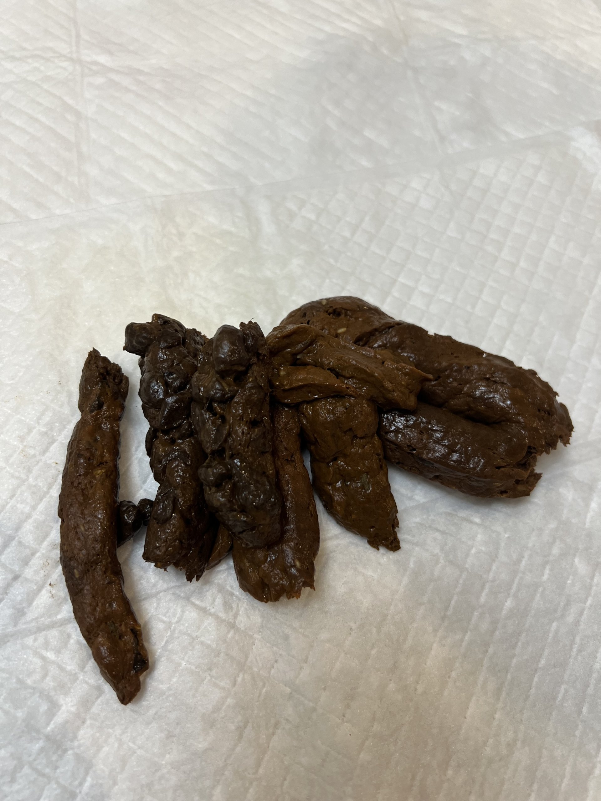 Stinky Fart and Poop 💩