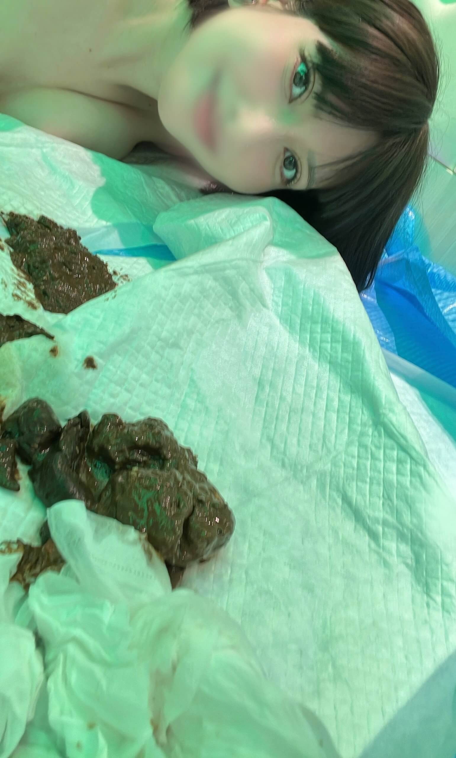 大量ゆるめうんちで呼吸管理